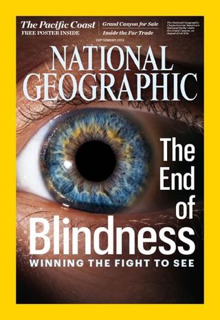 全球週刊封面：基因工程 瞎眼的得看見 （20160911 國家地理雜誌）
